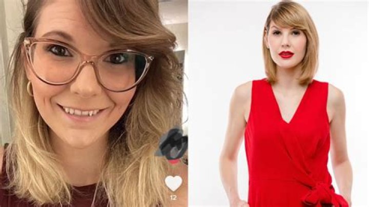 Ashley Leechin Plastic Surgery Before And After: What Is Wrong With Her Face?