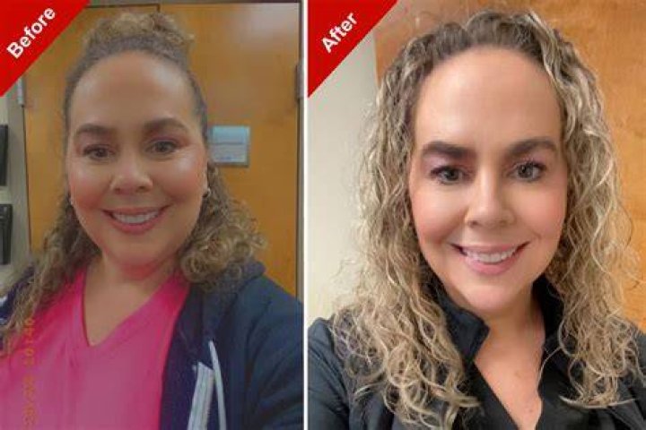 Brittany Furlan Plastic Surgery Viral On Tiktok: Before And After Photo