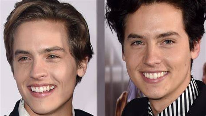 Cole Sprouse Teeth Before And After -Has He Used Braces And Whitened Them?