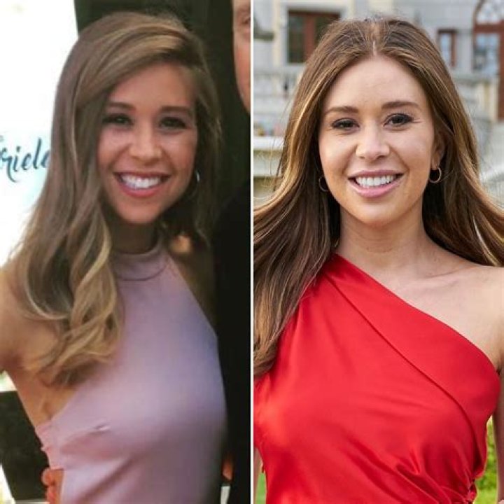 Did Gabby Windey From The Bachelorette Get Plastic Surgery? Here Are Before And After Pictures