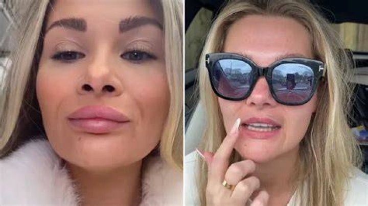 
Did Shaughna Phillips Gain Weight? LOve Island Star Ditches Lip Fillers And Looks Different 