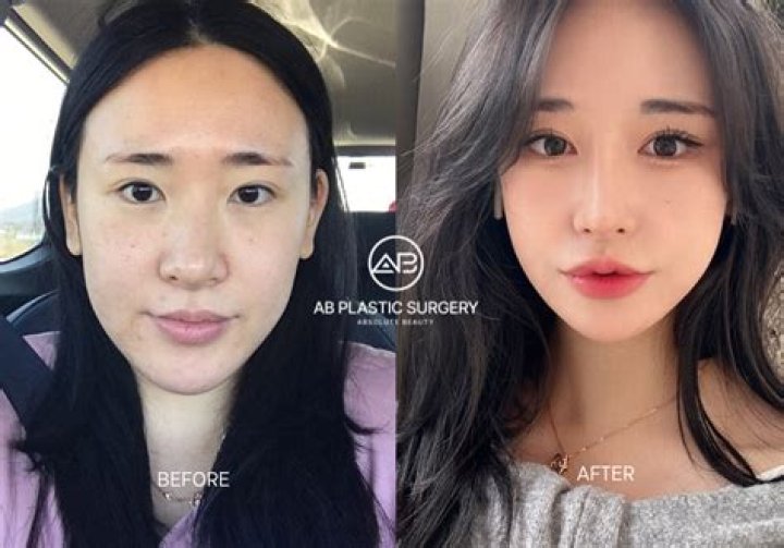 
Gangnam Plastic Surgery Clinic IP Cam Video Leaked Went Viral 