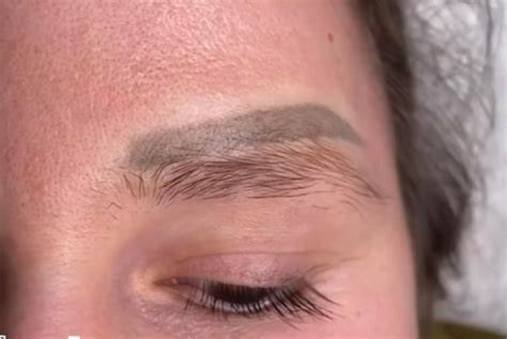 Is Matt Smith No Eyebrows linked To Cancer? Illness And Disease Update