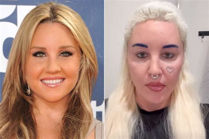 
Lacey Wildd Plastic Surgery Before And After, Where Is She Now? 
