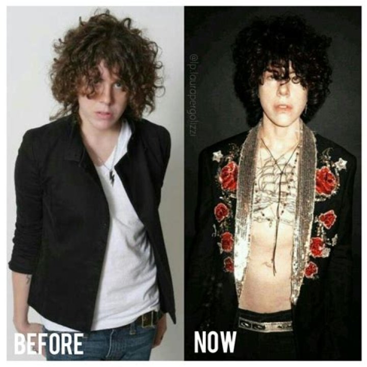 Laura Pergolizzi Transgender – What Is Her Gender? Surgery Before And After Pics