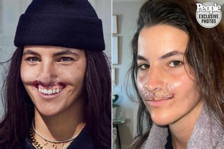 
Maria Shriver Health Update: What Happened To Her? Did She Had Stroke Again? 