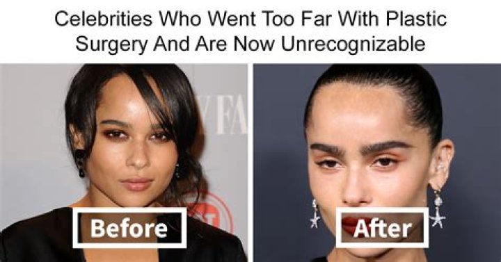 Morgan Riddle Plastic Surgery – Before And After Photos