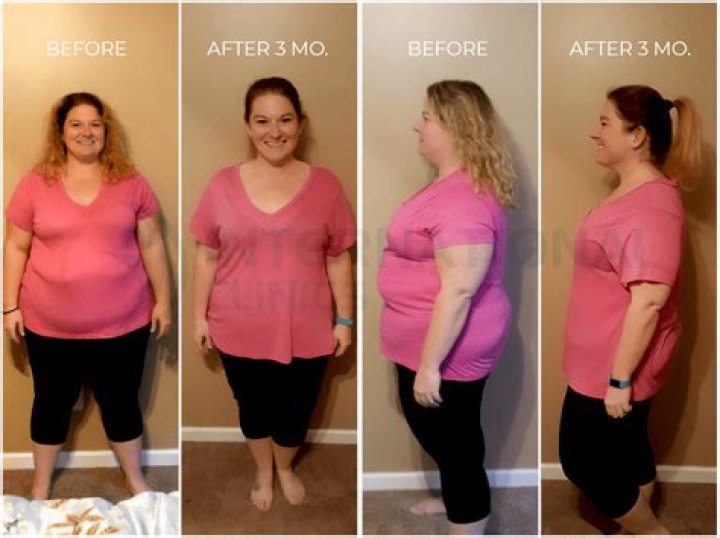 Muni Long Weight Loss Journey, Plastic Surgery – Before And After Photos