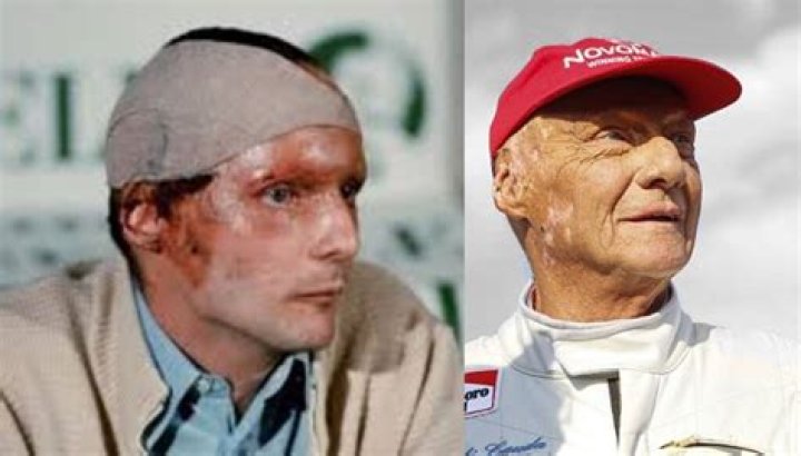 Niki Lauda Death Cause -What Happened To Him? Details To Know