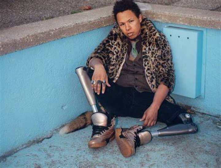 Queer As Folk: What Happened To Eric Graise? Accident Details – Was He Amputated?