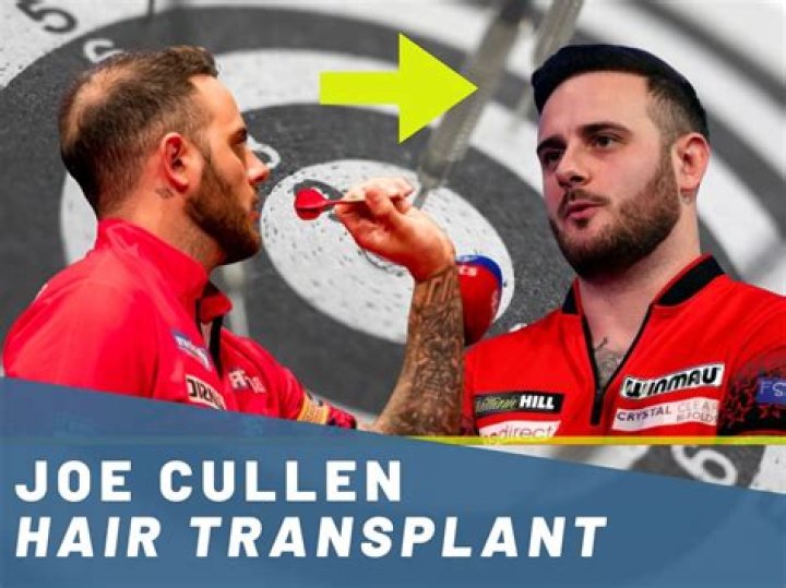 
What Happened To Joe Cullen Hair? Darts 13 Tattoo Meaning & Net Worth 