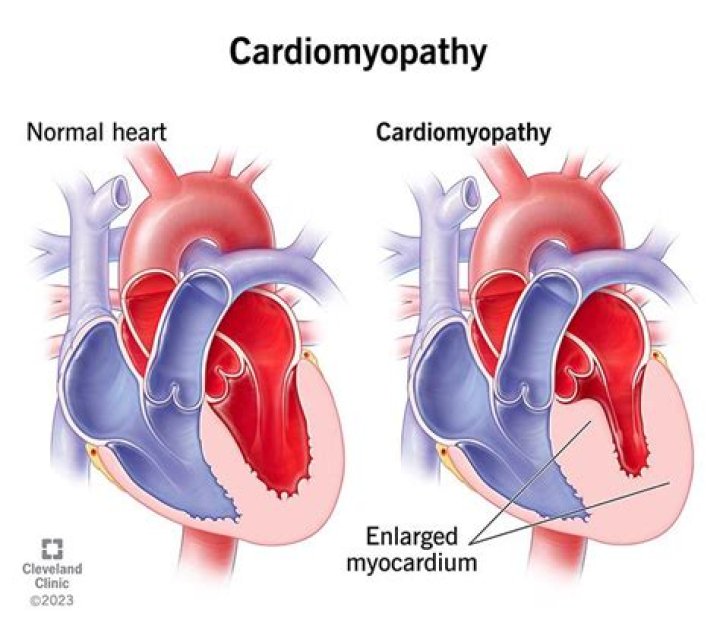 
What is Cardiomyopathy? Coolio’s condition and cause of death explored 6 months after rapper’s demise 