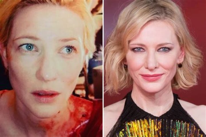 
What Is Wrong With Cate Blanchett Health? Head Injury And Surgery Update 