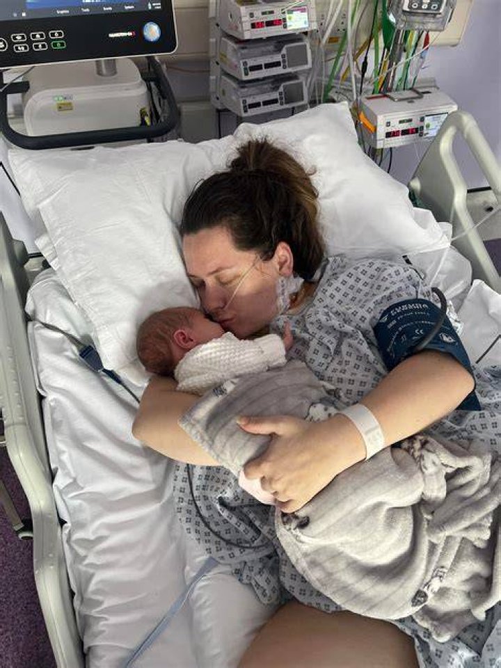 
Who is Charleigh Chatterton, English woman who nearly died from rare flesh-eating bacteria? 