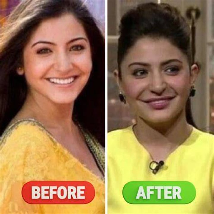 Who Is Doresani Chethana Raj? 21 Year Old Actress Becomes Death Victim Of Plastic Surgery Gone Wrong